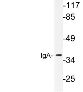 Western blot analysis of lysate from HeLa cells using Anti-IgA Antibody