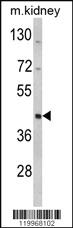 Anti-WSB2 Rabbit Polyclonal Antibody