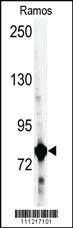 Anti-GARS Rabbit Polyclonal Antibody