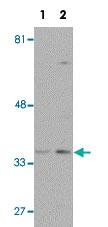 Anti-WDR92 Rabbit Polyclonal Antibody