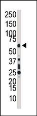 Anti-MAP3K7 Rabbit Polyclonal Antibody