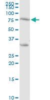 Anti-PRKCH Rabbit Polyclonal Antibody