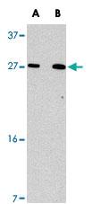 Anti-KLRAP1 Rabbit Polyclonal Antibody