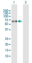 Anti-PACSIN2 Rabbit Polyclonal Antibody