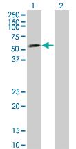 Anti-LEF1 Mouse Monoclonal Antibody [clone: 2E2]