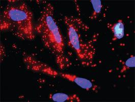 Anti-GP1BA + FLNA Antibody Pair