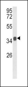 Anti-KLF6 Rabbit Polyclonal Antibody