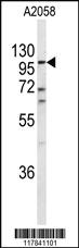 Anti-ECE1 Rabbit Polyclonal Antibody