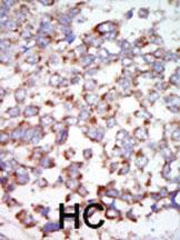 Anti-MAP3K7 Rabbit Polyclonal Antibody