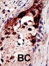 Anti-EPN2 Rabbit Polyclonal Antibody (HRP (Horseradish Peroxidase))