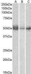 Anti-IDO1 Antibody (A84136) (05 µg/ml) staining of Human Lymph Node (A), Spleen (B) and Placenta (C) lysates (35 µg protein in RIPA buffer) Primary incubation was 1 hour Detected by chemiluminescence