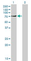 Anti-PRKCI Mouse Monoclonal Antibody [clone: 1G11]