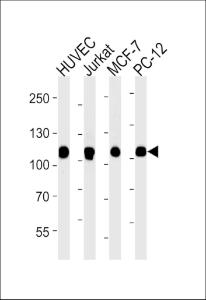 Anti-TOP1 Mouse Monoclonal Antibody [clone: 1291CT875.142.166]