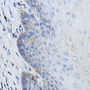 Immunohistochemistry analysis of paraffin-embedded human esophagus using Anti-CD46 Antibody (A11467) at a dilution of 1:100 (40X lens). Perform high pressure antigen retrieval with 10 mM citrate buffer pH 6.0 before commencing with IHC staining protocol