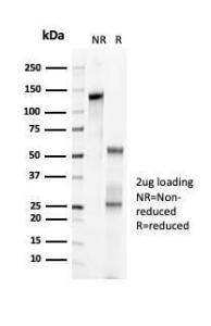 SDS-PAGE analysis of Anti-p57 Kip2 Antibody [KIP2/7083R] under non-reduced and reduced conditions; showing intact IgG and intact heavy and light chains, respectively. SDS-PAGE analysis confirms the integrity and purity of the antibody