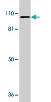 Anti-MTBP Rabbit Polyclonal Antibody