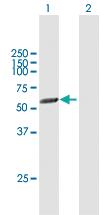 Anti-PICK1 Mouse Polyclonal Antibody