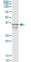 Anti-TYMS Antibody Pair