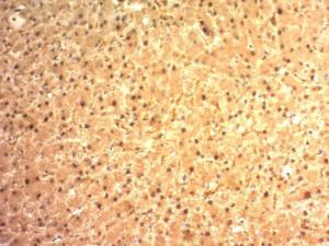 Anti-Glypican 3 Mouse Monoclonal Antibody [clone: SPM595]