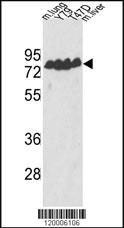 Anti-BAIAP2L2 Rabbit Polyclonal Antibody