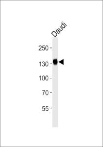 Anti-USP25 Mouse Monoclonal Antibody [clone: 1277CT376.106.171]