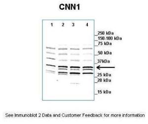 Anti-CNN1 Rabbit Polyclonal Antibody