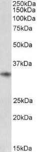 Anti-CD74 Antibody (A82638) (0.01 µg/ml) staining of Human Tonsil lysate (35 µg protein in RIPA buffer). Primary incubation was 1 hour. Detected by chemilu minescence