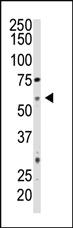 Anti-NT5E Rabbit Polyclonal Antibody