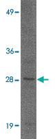 Anti-KLRA3 Rabbit Polyclonal Antibody