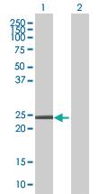 Anti-CSDC2 Mouse Polyclonal Antibody