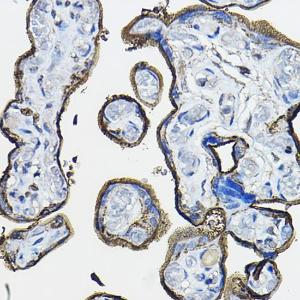 Immunohistochemistry analysis of paraffin-embedded human placenta using Anti-CD46 Antibody (A11467) at a dilution of 1:100 (40X lens). Perform high pressure antigen retrieval with 10 mM citrate buffer pH 6.0 before commencing with IHC staining protocol