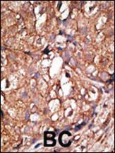 Anti-NT5E Rabbit Polyclonal Antibody