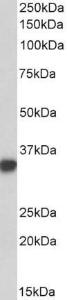 Anti-CD74 antibody