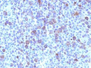 Anti-Glypican 3 Mouse Monoclonal Antibody [clone: SPM595]