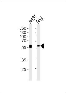 Anti-LYN Mouse Monoclonal Antibody [clone: 1174CT22.3.1.1]