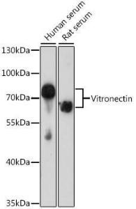 Anti-Vitronectin/S-Protein Antibody (A11468)