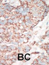 Anti-STK25 Rabbit Polyclonal Antibody