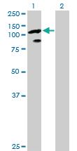 Anti-TCEB3 Rabbit Polyclonal Antibody