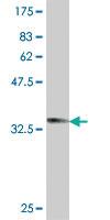 Anti-HELQ Mouse Polyclonal Antibody