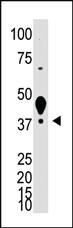 Anti-LYVE1 Rabbit Polyclonal Antibody