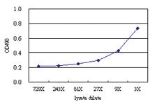 Anti-ZNF215 Antibody Pair