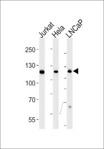 Anti-USP11 Mouse Monoclonal Antibody [clone: 1220CT620.193.189]