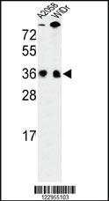 Anti-SRSF1 Rabbit Polyclonal Antibody