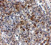 Anti-OCC1 Rabbit Polyclonal Antibody