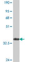 Anti-CDC42BPB Mouse Polyclonal Antibody