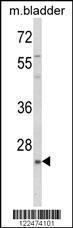 Anti-KLF16 Rabbit Polyclonal Antibody