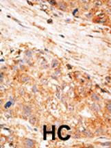 Anti-LIVIN Rabbit Polyclonal Antibody (AP (Alkaline Phosphatase))