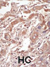 Anti-STK10 Rabbit Polyclonal Antibody (AP (Alkaline Phosphatase))