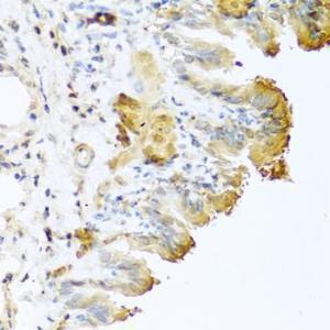 Immunohistochemistry analysis of paraffin-embedded mouse lung using Anti-Vitronectin/S-Protein Antibody (A11468) at a dilution of 1:100 (40X lens)