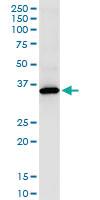 Anti-TYMS Polyclonal Antibody Pair